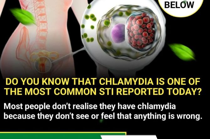 When Last Did You Treat Chlamydia
