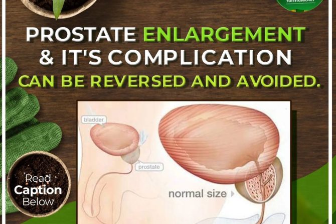 Prostate Enlargement and Its Complications